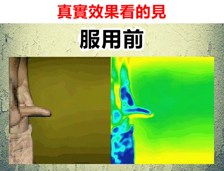 010.gif